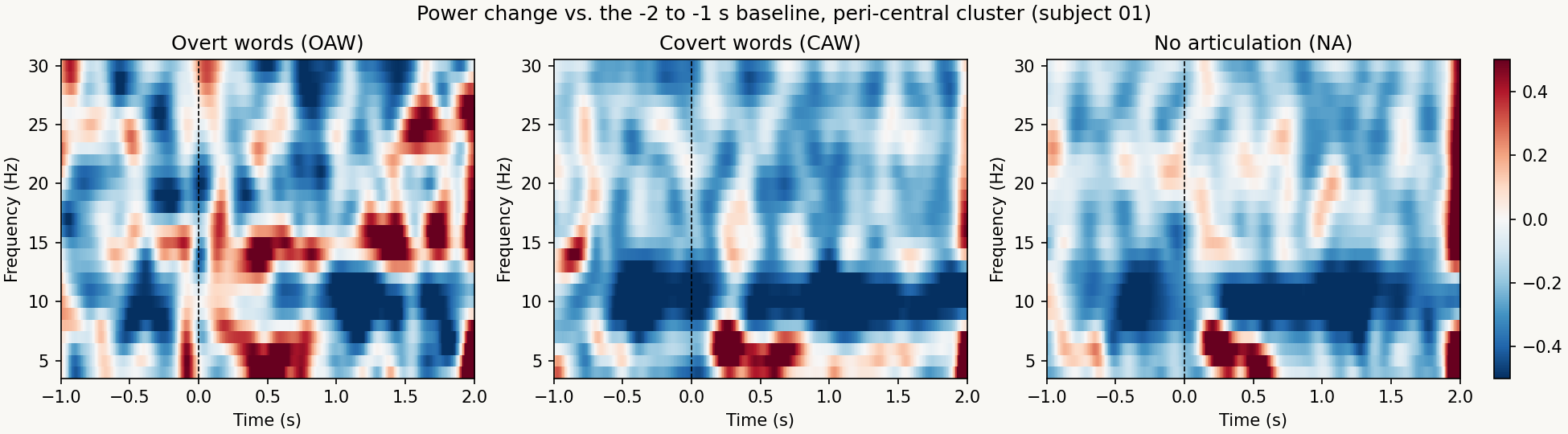 Time–frequency maps for overt, covert and control conditions