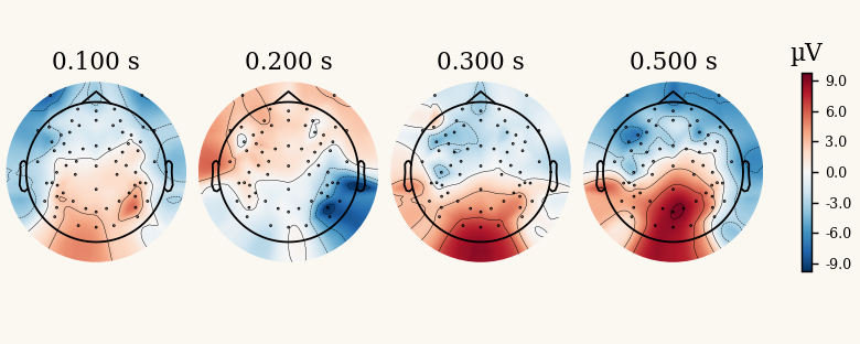Scalp topographies of an event-related potential at four latencies